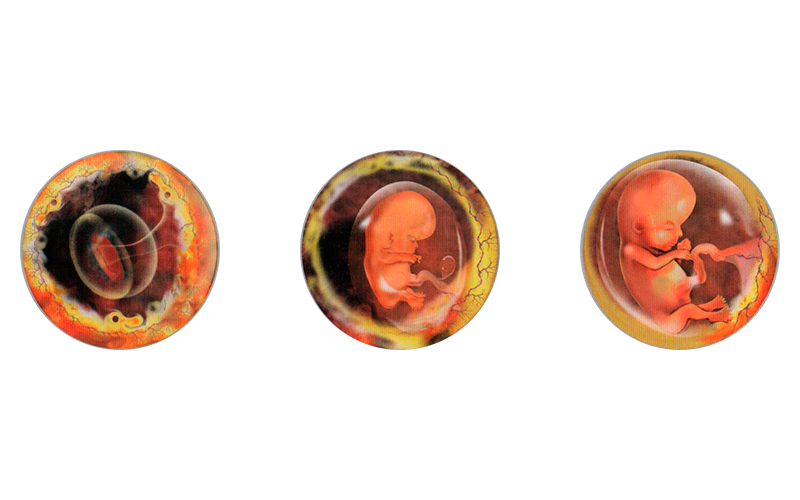 003. El Crecimiento del Bebé en el Primer Trimestre