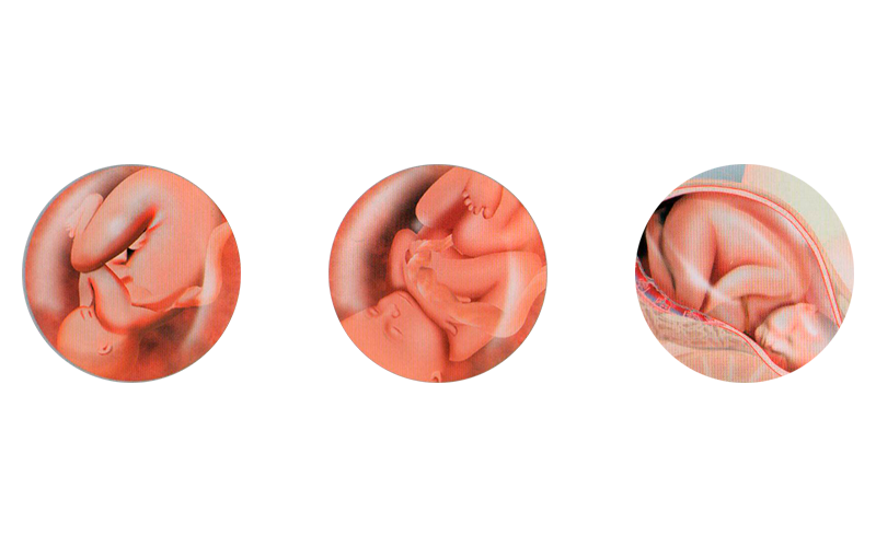 005. El Crecimiento del Bebé en el Tercer Trimestre